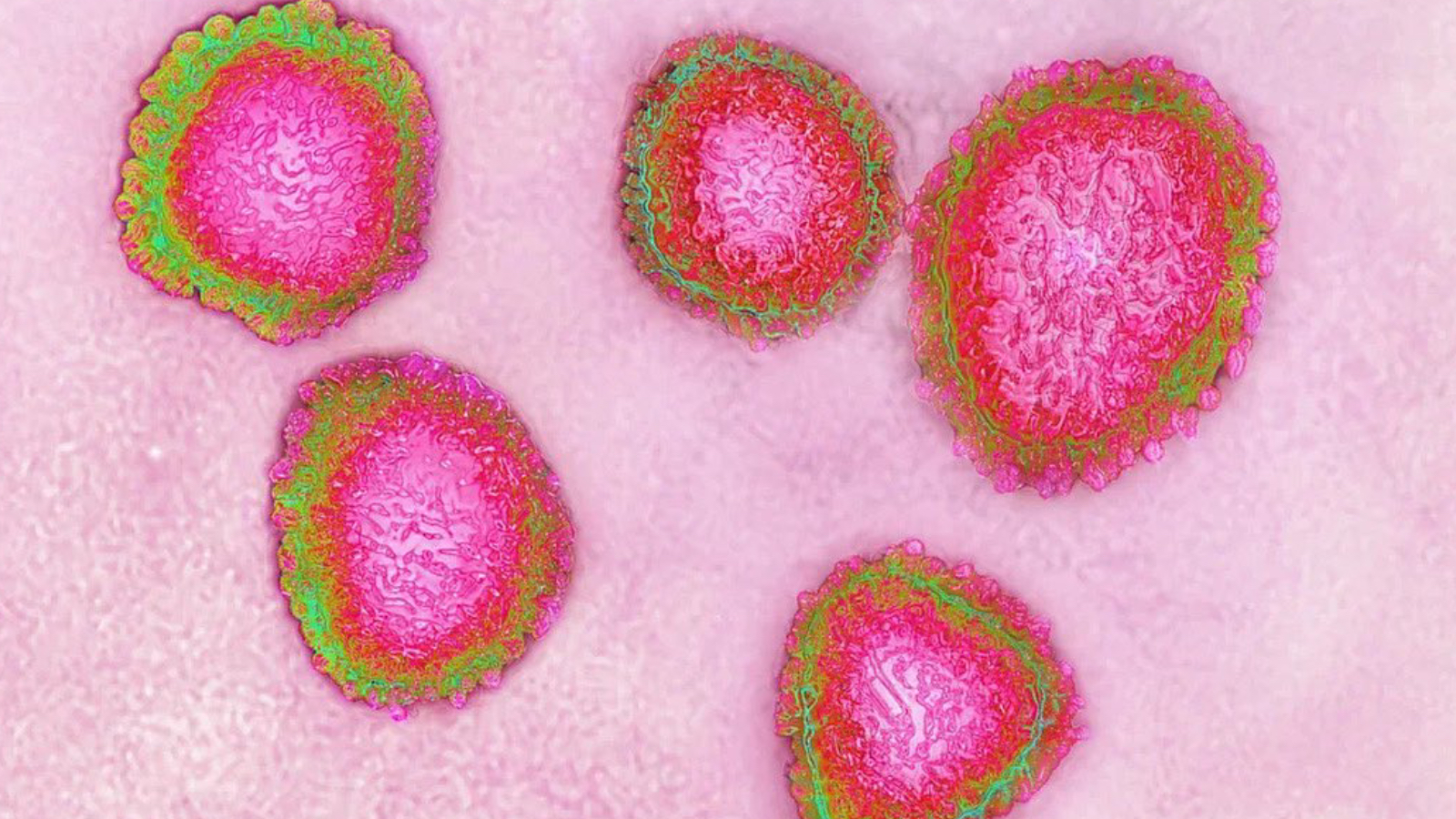 prof dr ceyhan uyariyor covid azalma noktasinda degil her yil artiyor turkiyede asisi yok KUXqVBGR